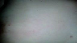Thumb 15